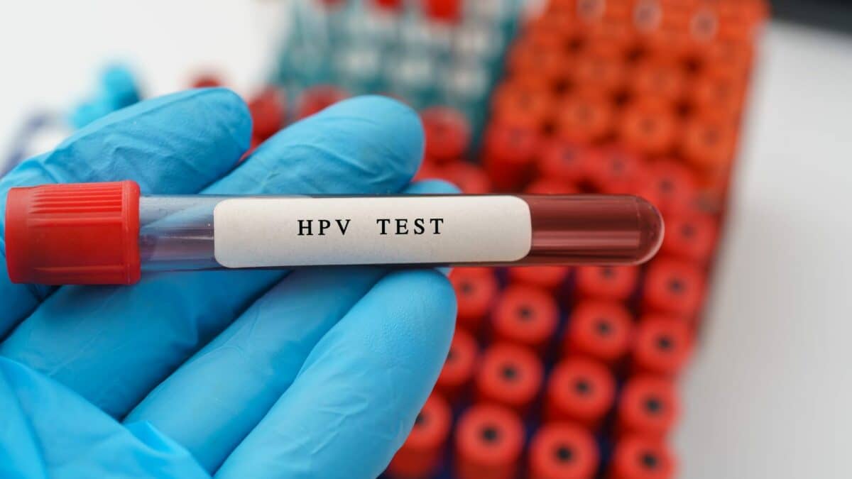 HPV Testing